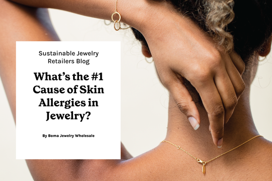 The #1 Cause of Skin Allergies in Jewelry